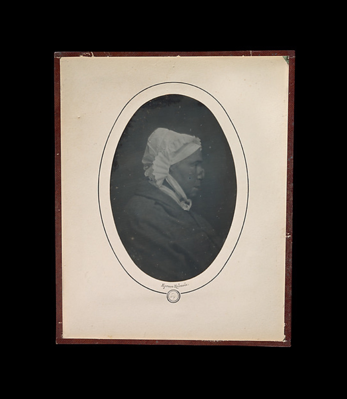 [Profile of a Woman with Necrosis of the Nose] — Louis-Auguste Bisson