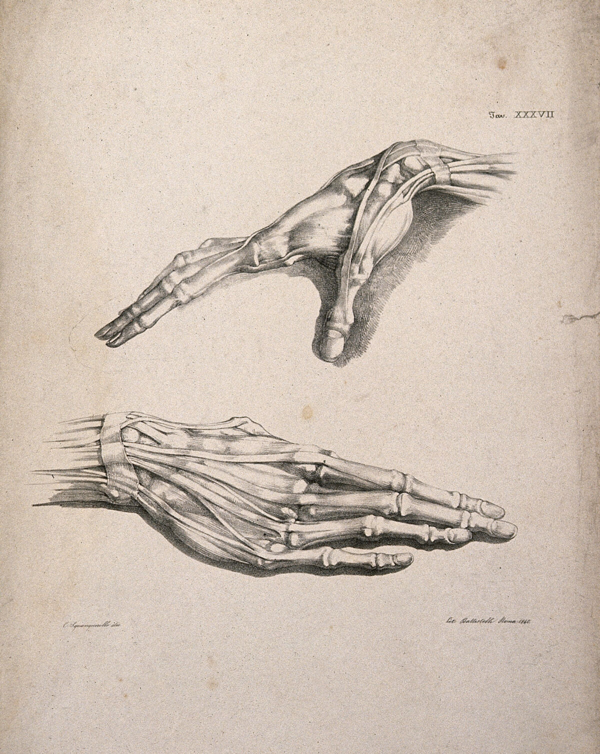Muscles and tendons of the hand: two figures of écorché hands. Lithograph by Battistelli after C. Squanquerillo, 1840. — Unknown artist