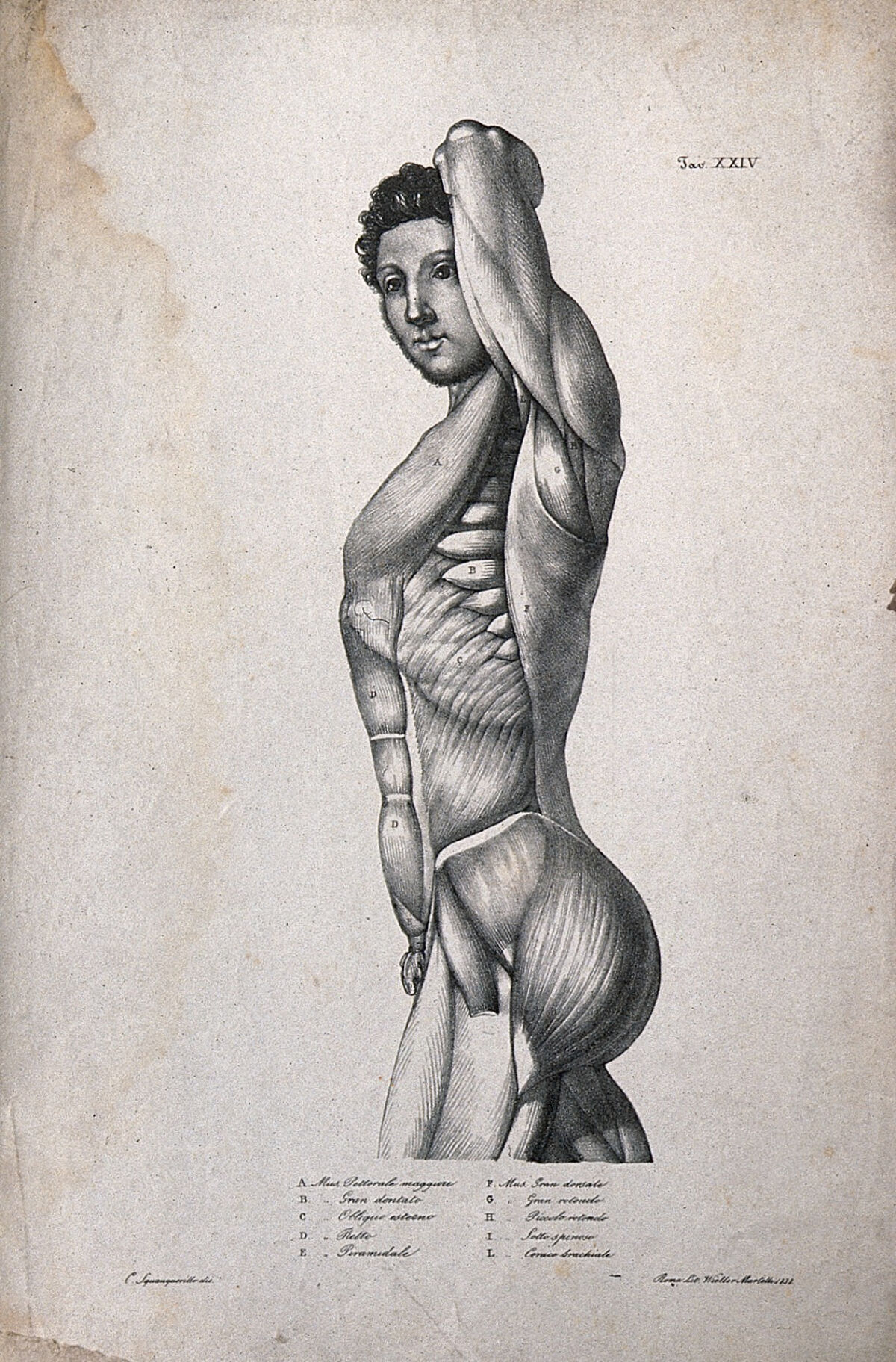 An écorché figure seen from the side. Lithograph by Wieller and Martelli after Squanquerillo, 1838. — Unknown artist