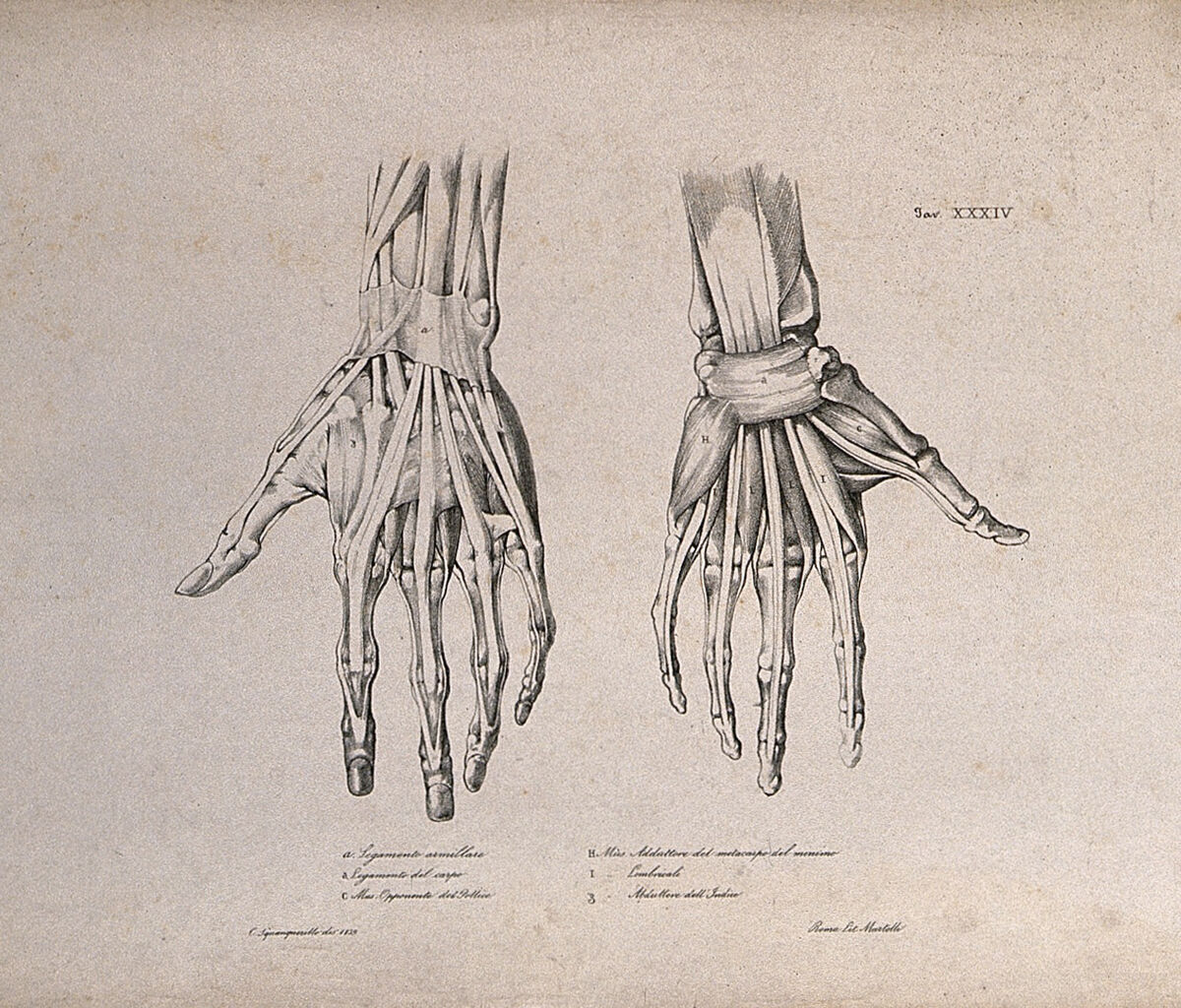 Muscles and ligaments of the hand: two figures of écorché hands. Lithograph by Martelli after C. Squanquerillo, 1839. — Unknown artist