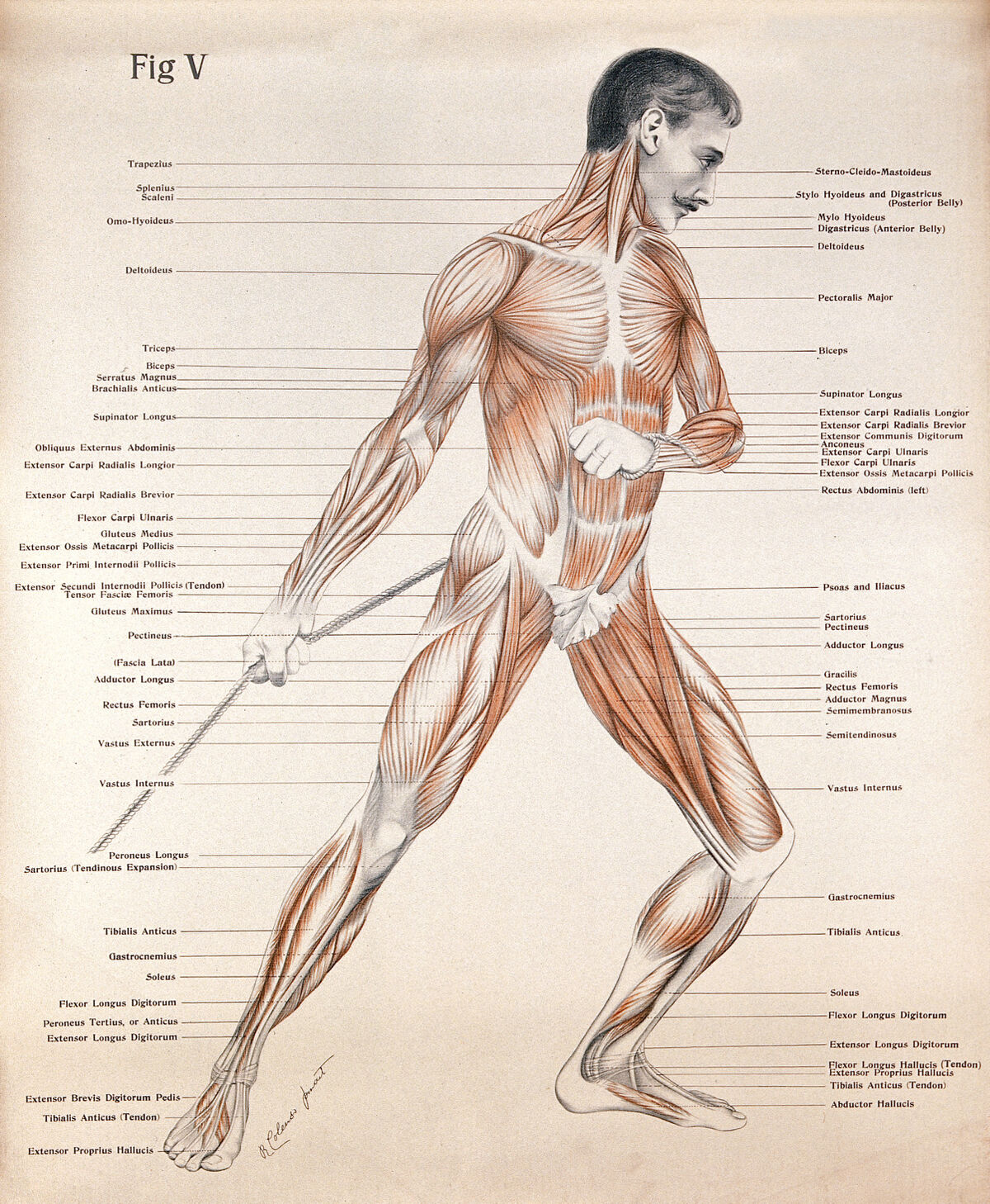 Artistic poses, plate V: a man, écorché, pulling a rope. Lithograph by Robert J. Colenso. — Unknown artist