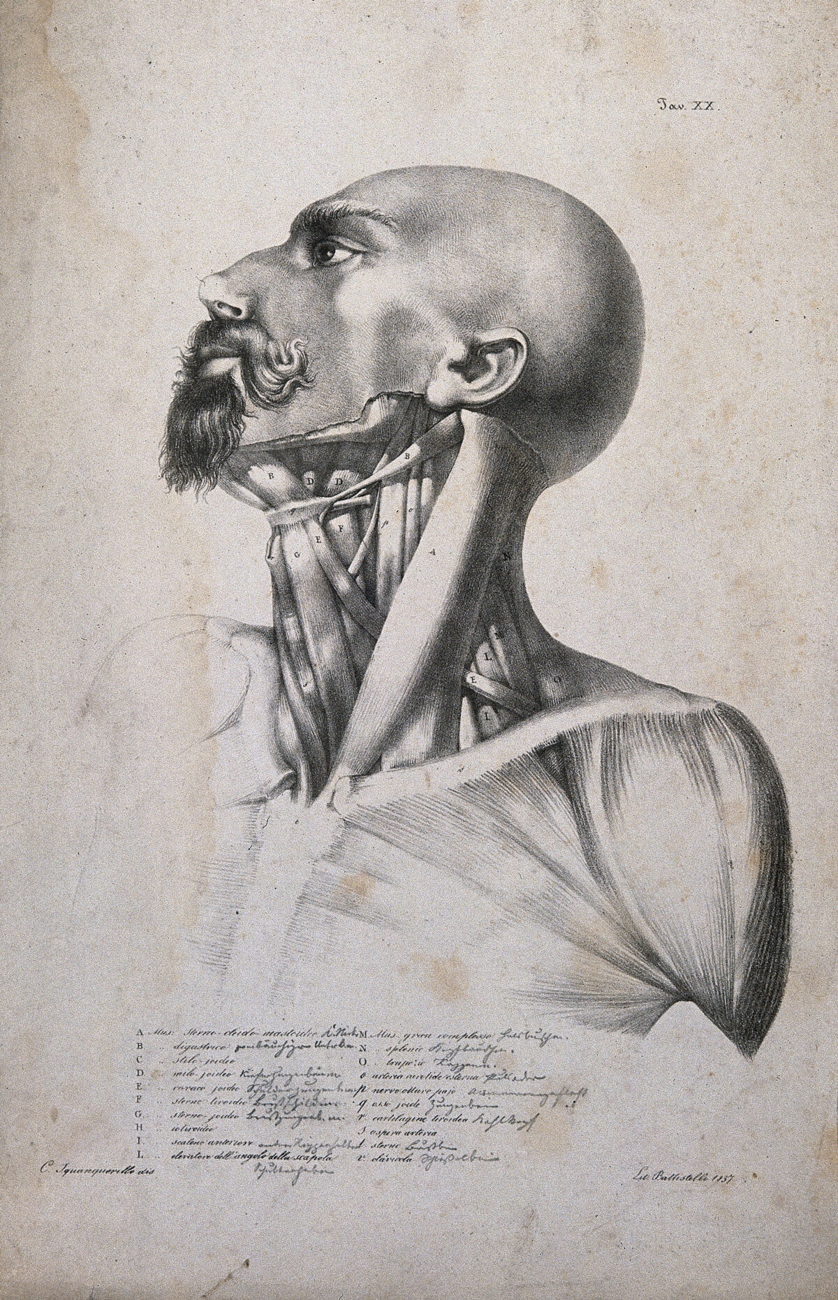An écorché head and shoulders, with neck muscles indicated. Lithograph by Battistelli after C. Squanquerillo, 1837. — Unknown artist