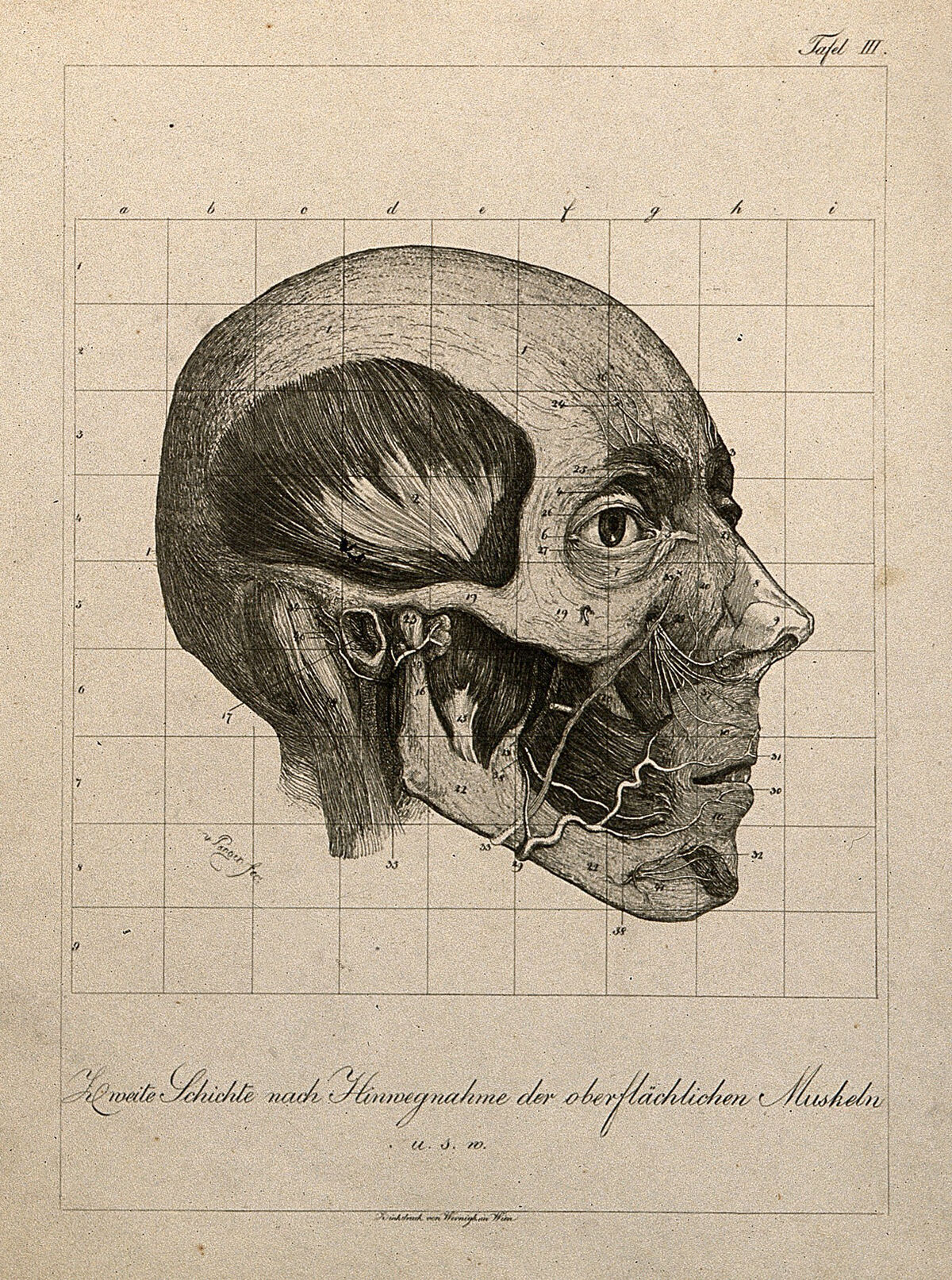 Écorché head of a man, shown at layer beneath superficial muscles, seen in profile. Etching, by A. von Perger, ca. 1850. — Artista ignoto