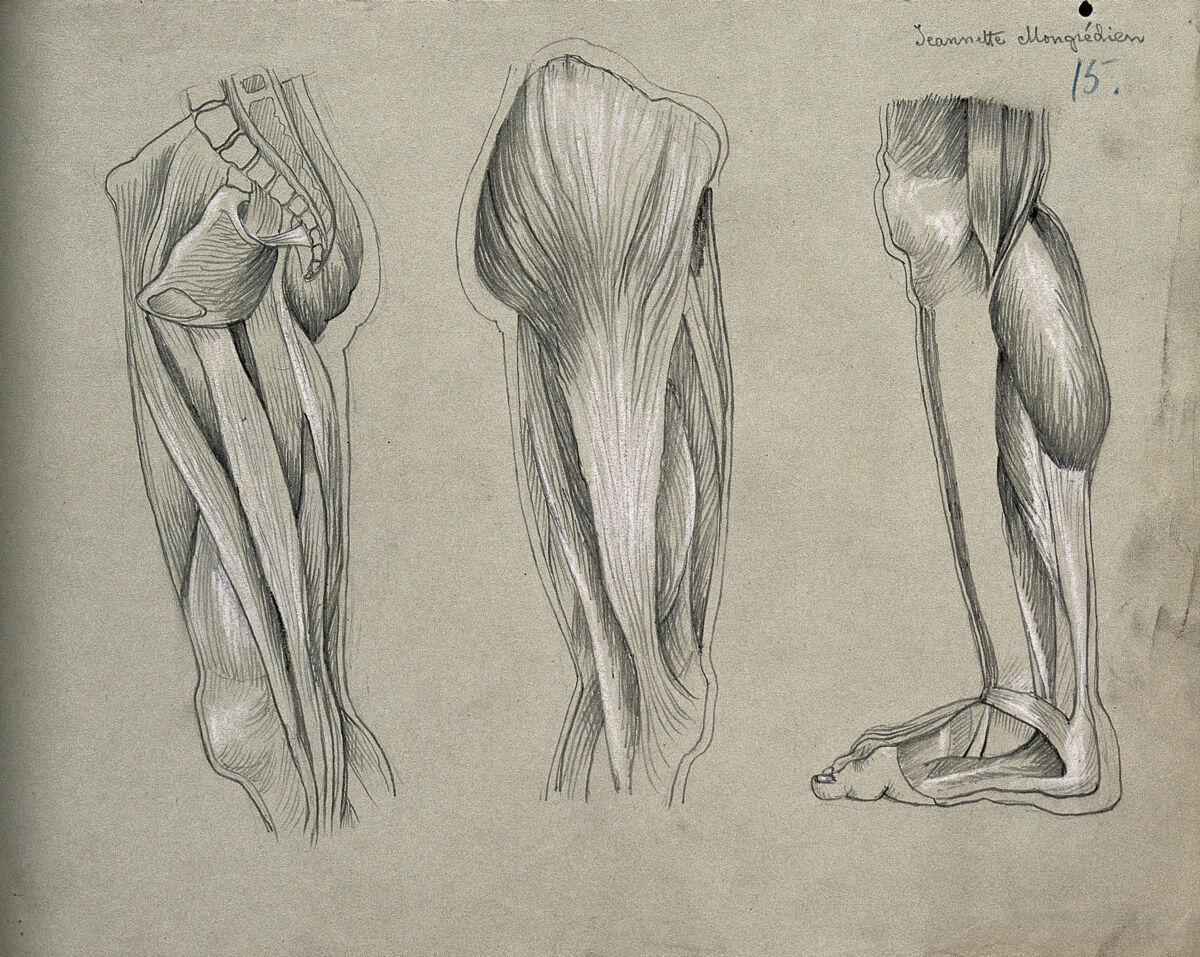 Muscles of the leg and foot: three figures. Pencil and chalk drawing by J. Mongrédien, ca. 1880. — Mongrédien, Jeannette