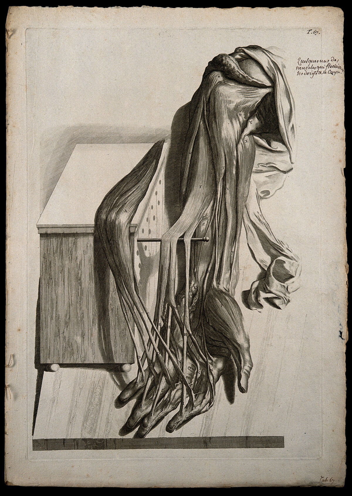 The flexor muscles of the arm, hand and fingers, separated from each other and raised through the use of a dowel and a perforated box. Engraving after G. de Lairesse, 1739. — Gerard de Lairesse