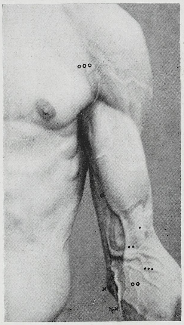 Braus 1921 169 — Braus, Hermann