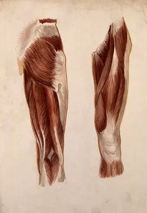 Muscles of the upper leg: five écorché figures. Watercolour by A. Mongrédien, ca. 1880. — Unknown artist