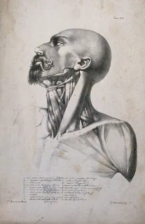 An écorché head and shoulders, with neck muscles indicated. Lithograph by Battistelli after C. Squanquerillo, 1837. — Unknown artist
