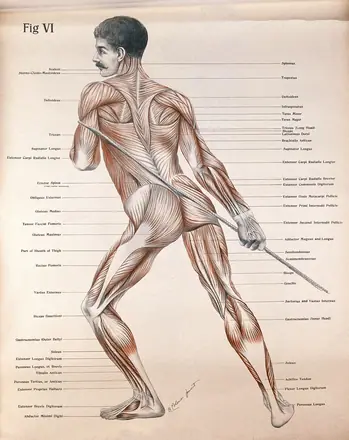 Artistic poses, plate VI: a man, écorché, pulling a rope. Lithograph by Robert J. Colenso. — Unknown artist