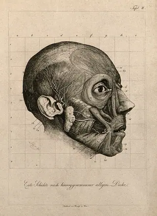 Écorché head of a man, subcutaneous level, seen in profile. Etching by A. von Perger, ca. 1850. — Unknown artist