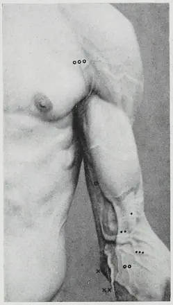 Braus 1921 169